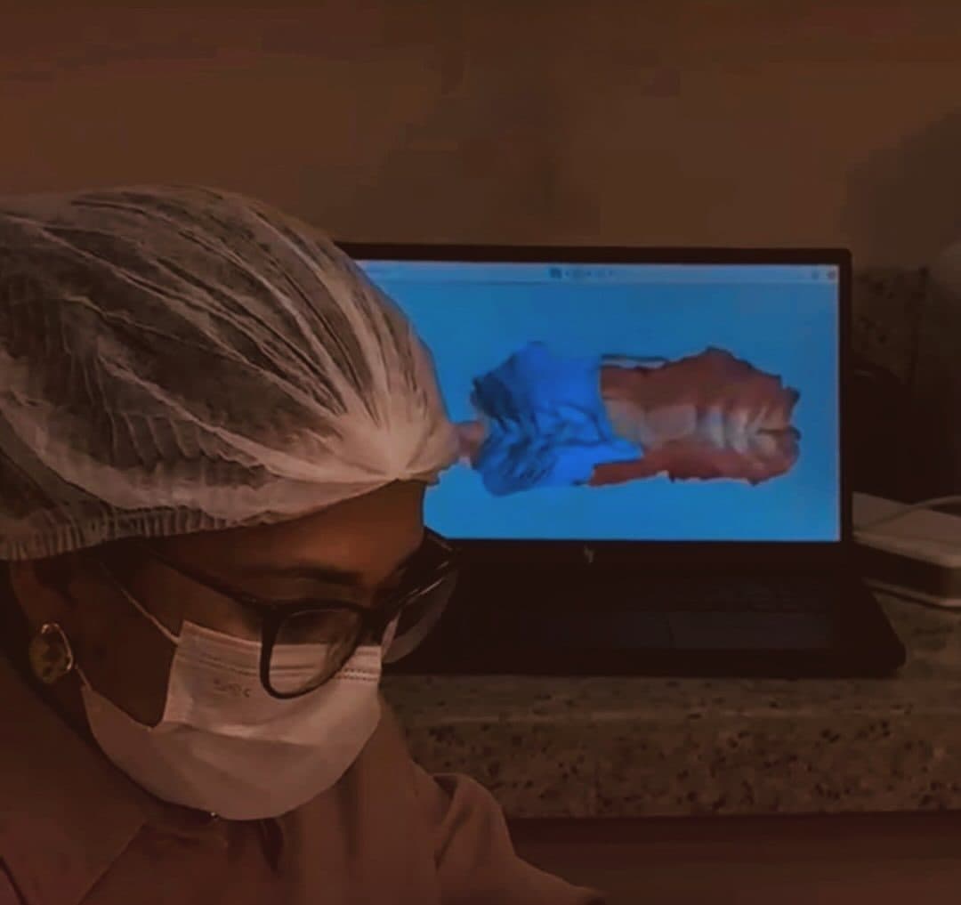 Escaneamento intraoral com a imagem dos dentes no monitor